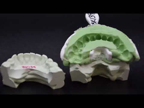 Dental Lab Technician Pours Stone Models [Video]